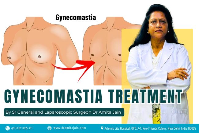 Best Doctor and Surgeon for Gynecomastia Dr Amita Jain